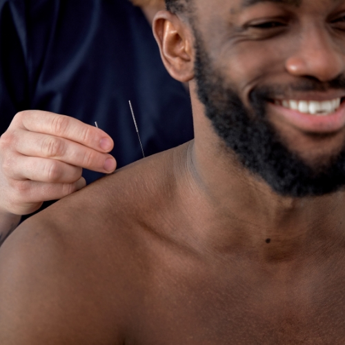 acupuncture-Mediways-Physiotherapy-Brampton-ON