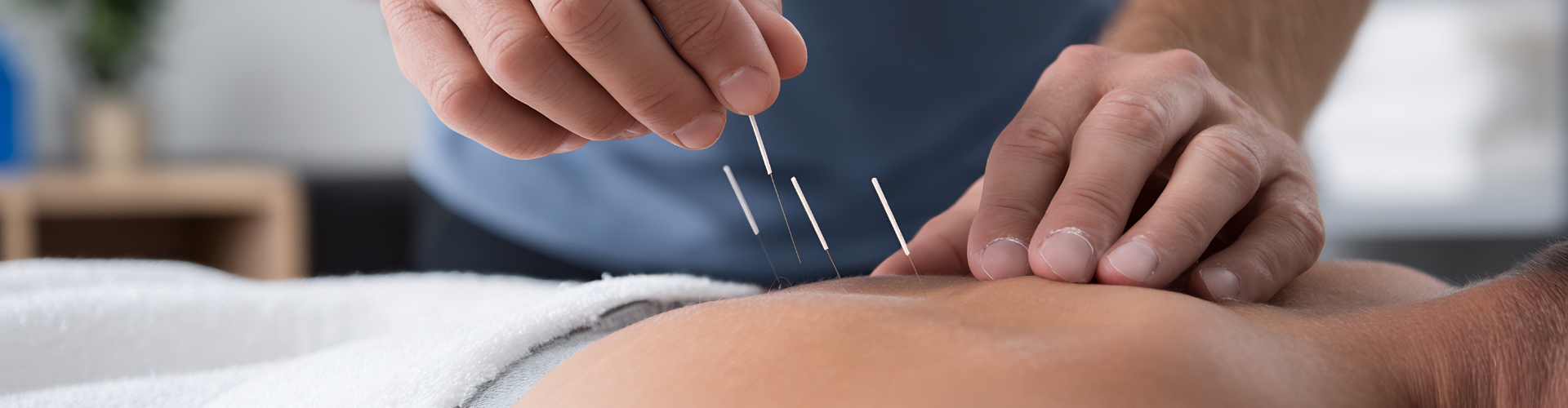 Dry Needling