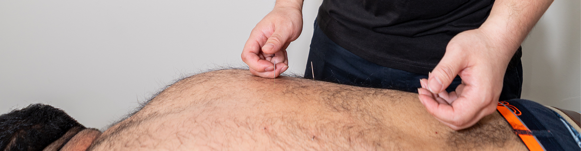 Dry Needling